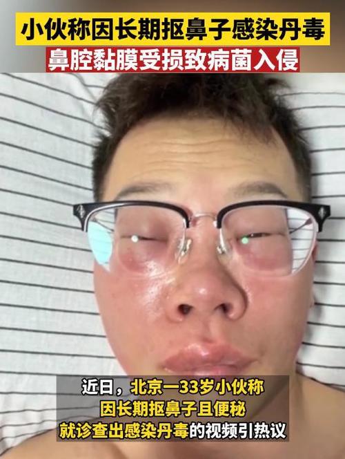 挖鼻孔满脸肿胀变形,挖鼻孔之后鼻孔肿了